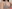 豊胸術（シリコンインプラント／人工乳腺） — ビュー極美容外科クリニック