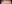 裏ハムラ法（経結膜的眼窩脂肪移動術） — コウユ美容外科クリニック