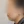 Belotero Revive (HA + glycerol skinbooster) — before (30days) · Vuraval Plastic Surgery Clinic