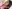 唇のヒアルロン酸注入（リップヒアルロン酸） — アウラ美容外科クリニック