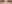 裏ハムラ法（経結膜的眼窩脂肪移動術） — ムイ美容外科クリニック