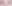 裏ハムラ法（経結膜的眼窩脂肪移動術） — ネイチャーオン美容外科クリニック