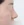 ผ่าตัดแก้ไขผนังกั้นช่องจมูกคด (Septoplasty) — หลังทำ (7วัน) · คลินิกศัลยกรรมพลาสติ์ พาดา