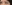 裏ハムラ法（経結膜的眼窩脂肪移動術） — アンド美容外科クリニック