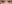 裏ハムラ法（経結膜的眼窩脂肪移動術） — ファクト美容外科クリニック