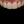 Orthodontic treatment (braces) — after (7days) · Gangnam Clear Dental Clinic