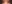 裏ハムラ法（経結膜的眼窩脂肪移動術） — ハッシュ美容外科クリニック