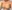 Breast augmentation with implants — Eight Plastic Surgery Clinic