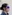 Double chin liposuction (submental liposuction) — Seoul During Clinic