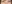 裏ハムラ法（経結膜的眼窩脂肪移動術） — アンド美容外科クリニック