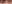 二重まぶた（自然癒着法） — プロミス美容外科クリニック