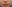 埋線拉提（線雕） — Claire整形外科診所