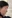 Augmentation rhinoplasty for a low/flat nasal bridge — Cowon Plastic Surgery Clinic