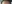 額縮小術（生え際下げ・ヘアライン下降術） — ザフィックス美容外科クリニック
