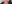 二重あごの脂肪吸引（顎下脂肪吸引） — ジェリム美容外科クリニック