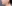 二重あごの脂肪吸引（顎下脂肪吸引） — クレア美容外科クリニック
