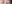 二重まぶた（自然癒着法） — ルホ美容外科クリニック