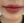 Full-face filler (full-face HA rejuvenation) — after · Shiny Clinic