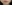 頬の脂肪吸引 — BN Plastic Surgery Clinic