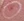 Insulated RF microneedle acne treatment (Agnes) — before (20days) · Garoseo Oriental Clinic - Gangnam Branch