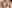 豊胸術（シリコンインプラント／人工乳腺） — バナナ美容外科クリニック
