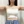 เลเซอร์สลายไขมันต้นขา — ก่อนทำ (60วัน) · คลินิกหมอซนยูนา