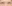 下眼瞼下制術（グラマラスライン形成・たれ目形成） — プロミス美容外科クリニック