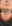 Double chin liposuction (submental liposuction) — You Can Be Plastic Surgery Clinic