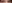 二重まぶた（自然癒着法） — フルルン美容外科クリニック