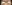 裏ハムラ法（経結膜的眼窩脂肪移動術） — アンド美容外科クリニック