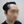 Hairline hair transplant (hairline lowering by grafting) — after (1days) · Vance Mosae Clinic