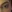 Forehead wrinkle Botox (frontalis lines) — Beauty Blossom Clinic