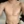 ผ่าตัดลดขนาดหน้าอก — หลังทำ (30วัน) · คลินิกเสริมความงามเชียงดัมโอเค