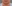 二重あごの脂肪吸引（顎下脂肪吸引） — クレア美容外科クリニック