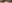 切開法（全切開法二重術） — Unique Plastic Surgery Clinic