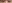 涙袋形成（脂肪注入） — ファクト美容外科クリニック