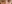 裏ハムラ法（経結膜的眼窩脂肪移動術） — プレジャー美容外科クリニック
