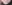 人中短縮（リップリフト） — プランナー美容外科クリニック