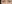 裏ハムラ法（経結膜的眼窩脂肪移動術） — プレジャー美容外科クリニック