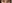 裏ハムラ法（経結膜的眼窩脂肪移動術） — プレジャー美容外科クリニック