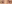 二重まぶた（自然癒着法） — プロミス美容外科クリニック