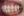 Clippy-C self-ligating ceramic braces (TOMY) — before (194days) · Lucent Dental Clinic