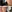 Dimple creation surgery (dimpleplasty) — Uri Plastic Surgery Clinic