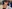 Alar base reduction (alarplasty) — Anersty Plastic Surgery Clinic