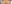 裏ハムラ法（経結膜的眼窩脂肪移動術） — アンド美容外科クリニック