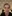 Facelift (rhytidectomy) — Uri Plastic Surgery Clinic