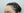 ปลูกผมบริเวณจอน — ก่อนทำ (180วัน) · คลินิกเสริมความงามเชียงดัมโอเค