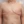ผ่าตัดลดขนาดหน้าอก — หลังทำ (28วัน) · The Plastic Surgery Clinic