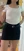Buttock Liposuction — before (30days) · Line & View Clinic