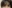 生え際アートメイク（ヘアラインアートメイク） — ゴールデンバランス女性クリニック